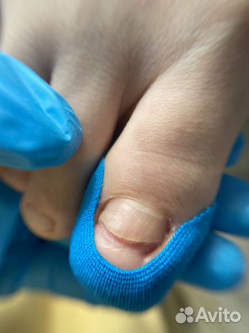 Подолог самара