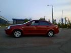 Chevrolet Lacetti 1.6 МТ, 2008, 169 990 км